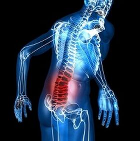osteohondroza