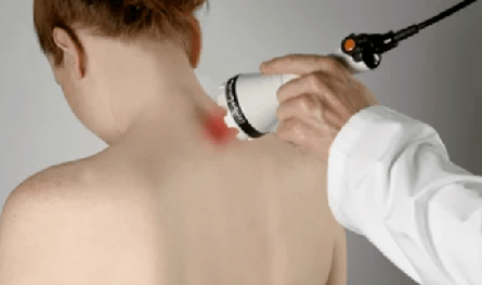 liječenje cervikalne osteohondroze pomoću fizioterapijskih metoda