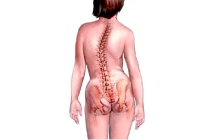 razlozi za razvoj cervikalne osteohondroze