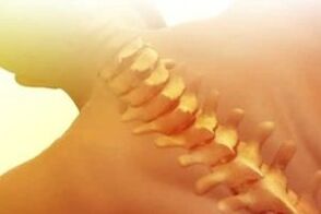 osteohondroza kako liječiti